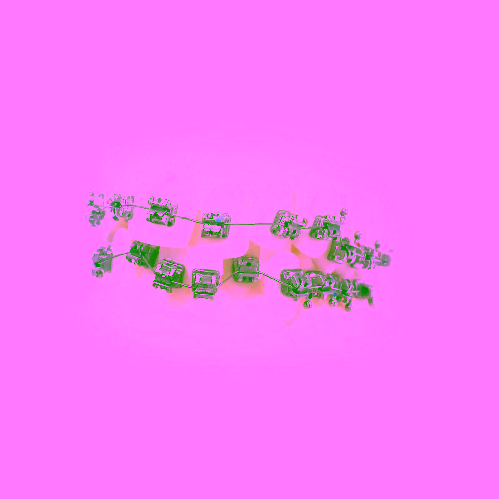 Arco Intraoral Copper NiTi 35°C Inferior Redondo Ø 0,40mm (.016")