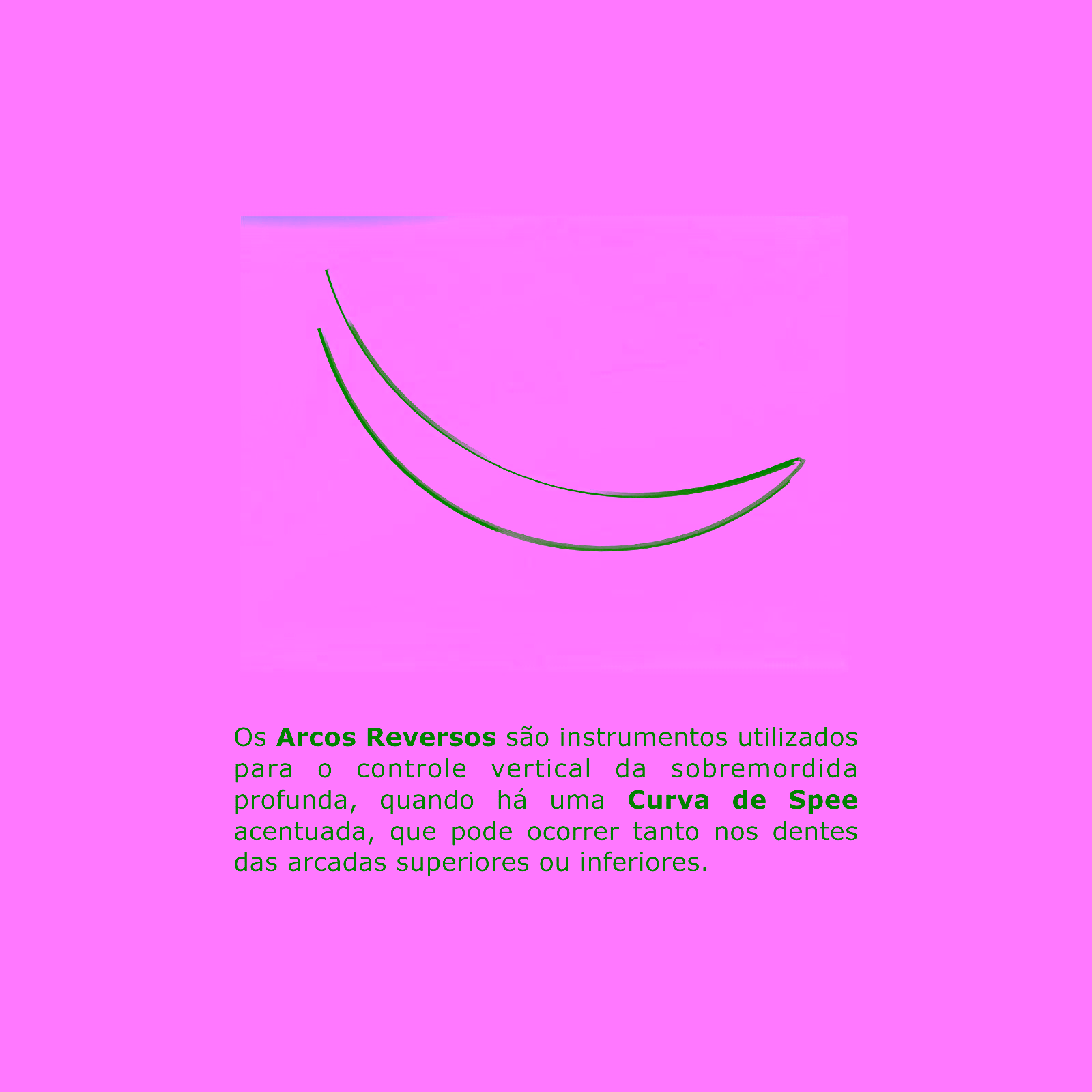 Arco Intraoral Reverso Spee Superelástico Grande NiTi Redondo Ø0,50mm (.020")