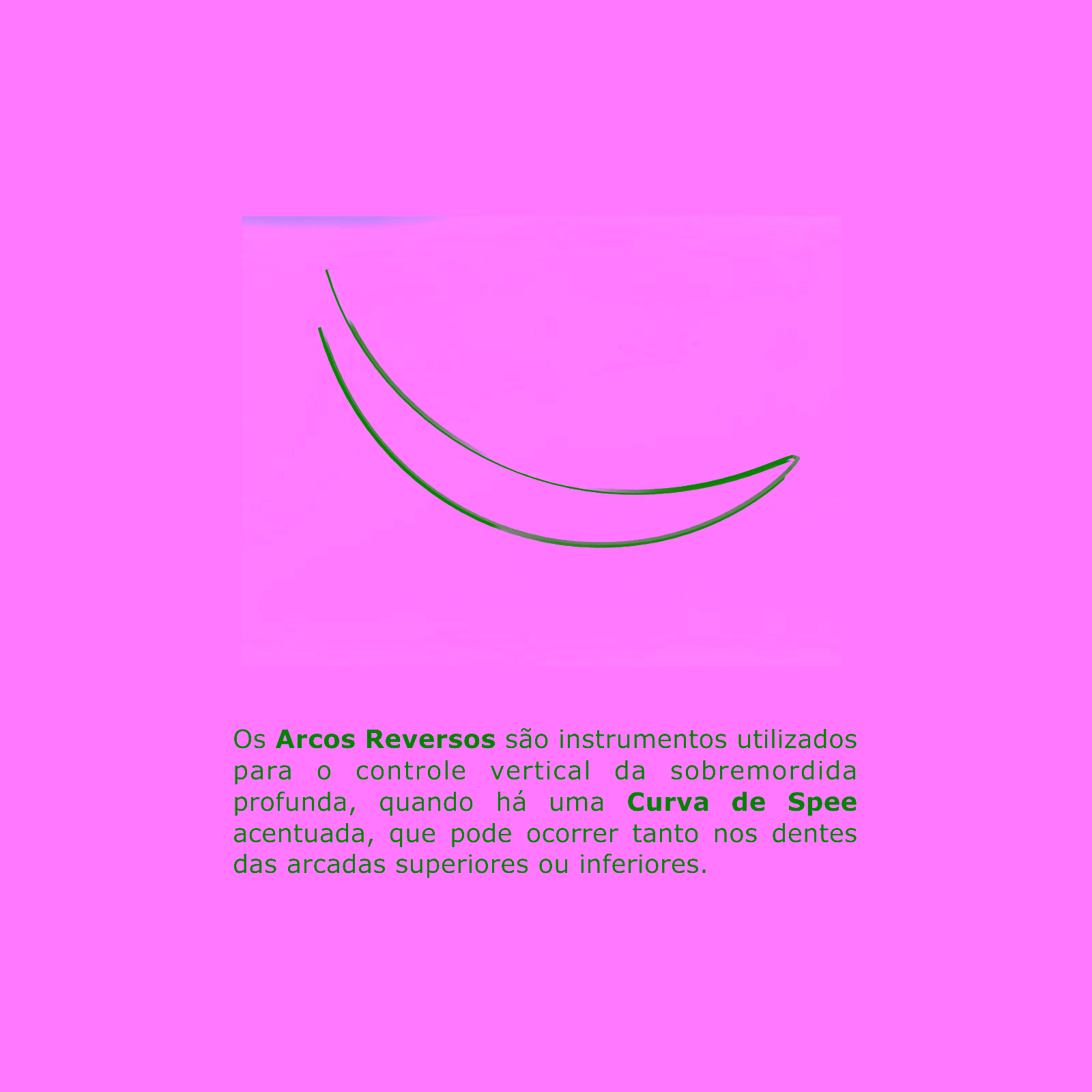 Arco Intraoral Reverso Spee Superelástico Grande NiTi 0,40x0,55mm (.016"x.022")