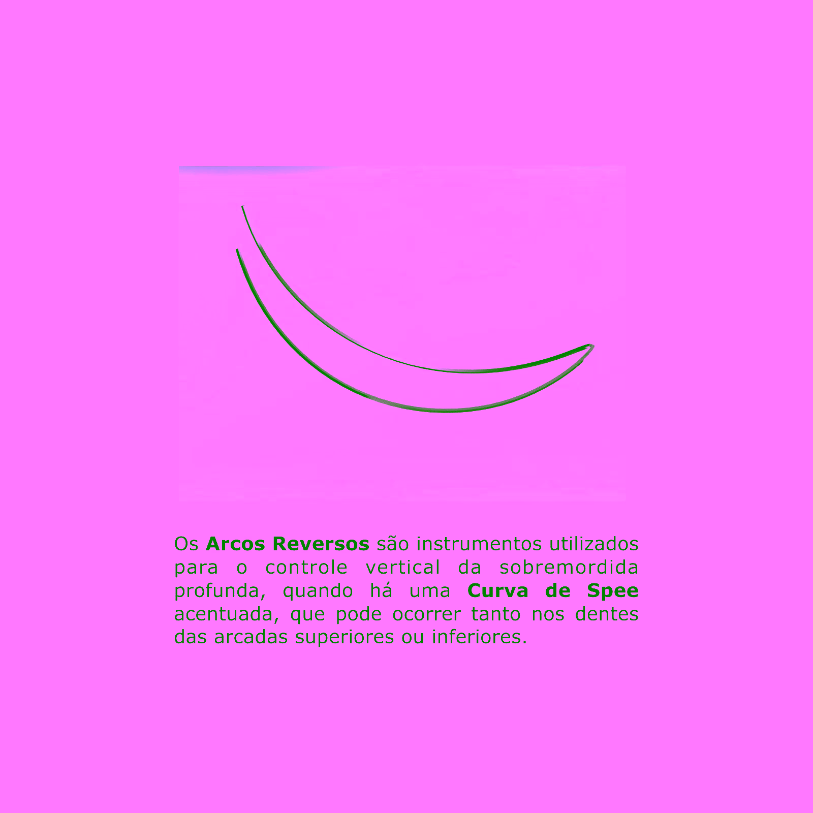 Arco Intraoral Reverso Spee Superelástico Medio NiTi Redondo Ø0,40mm (.016")