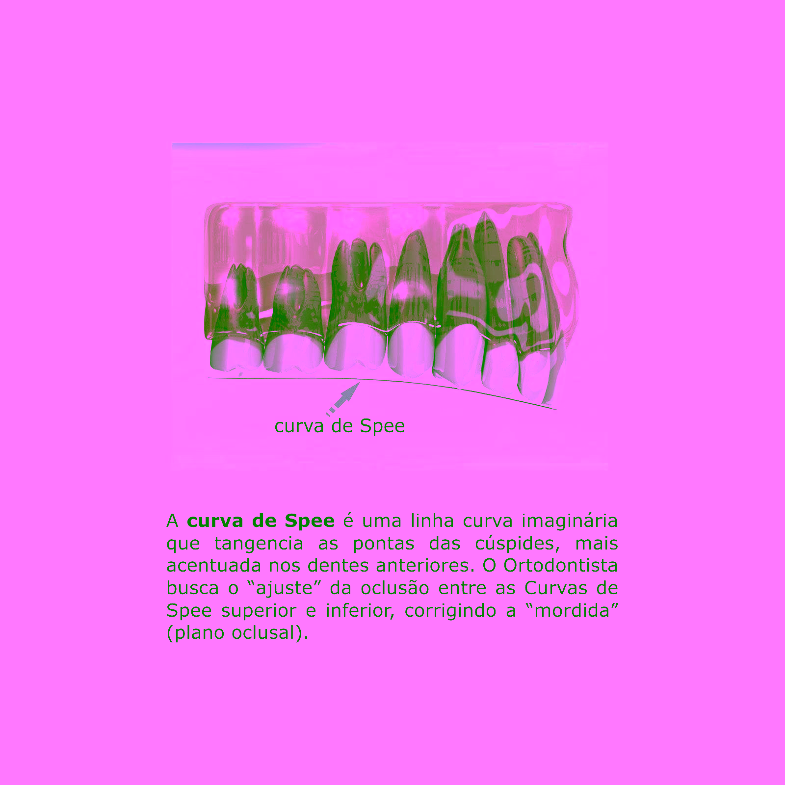 Arco Intraoral Reverso Spee Superelástico Medio NiTi Redondo Ø0,50mm (.020")