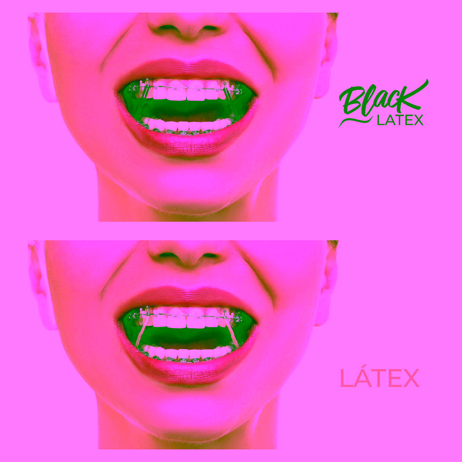 Elastico Intraoral Antimicrobiano Black Medio 5/16"