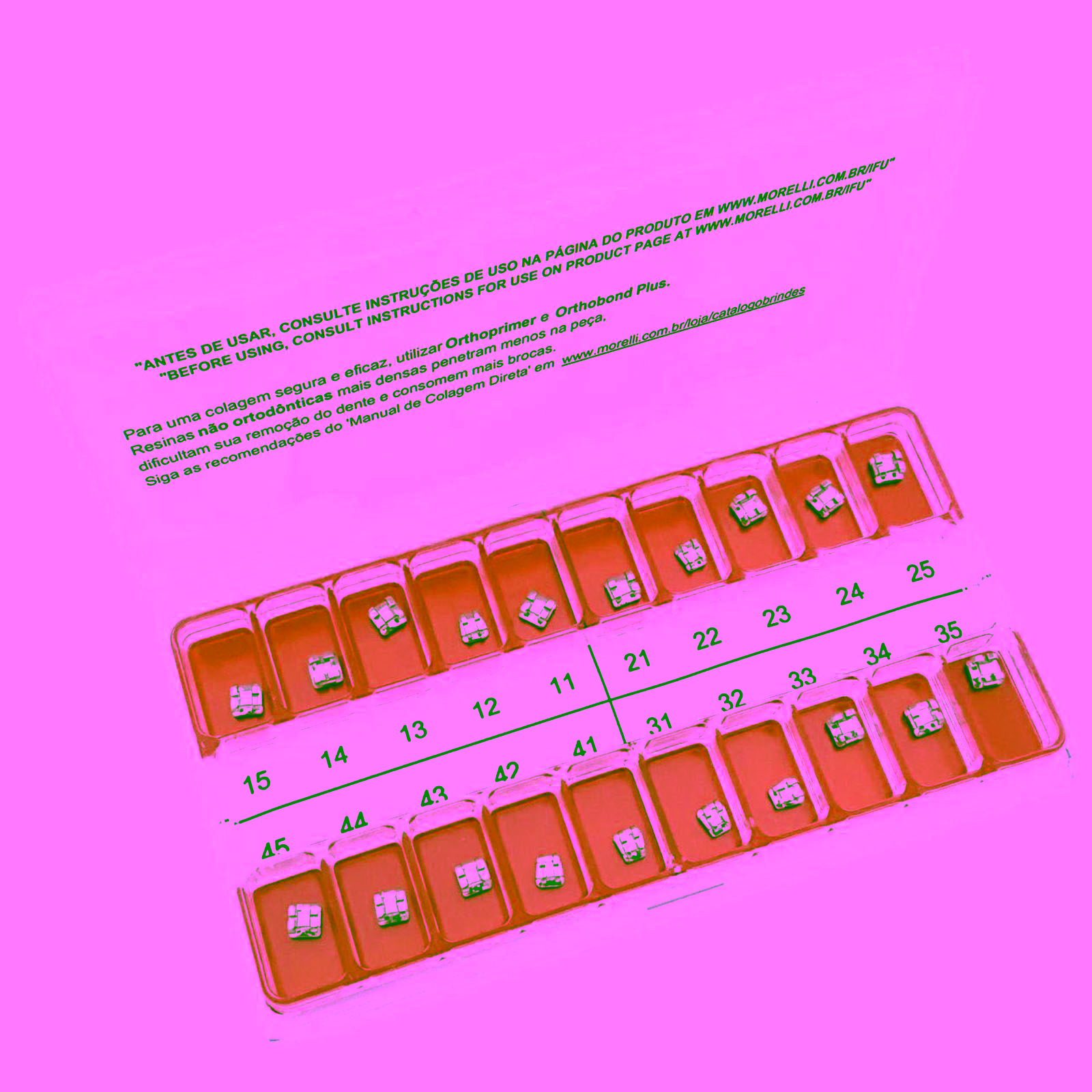 Kit de Brackets 01 caso Prescripción Edgewise Standard .018"