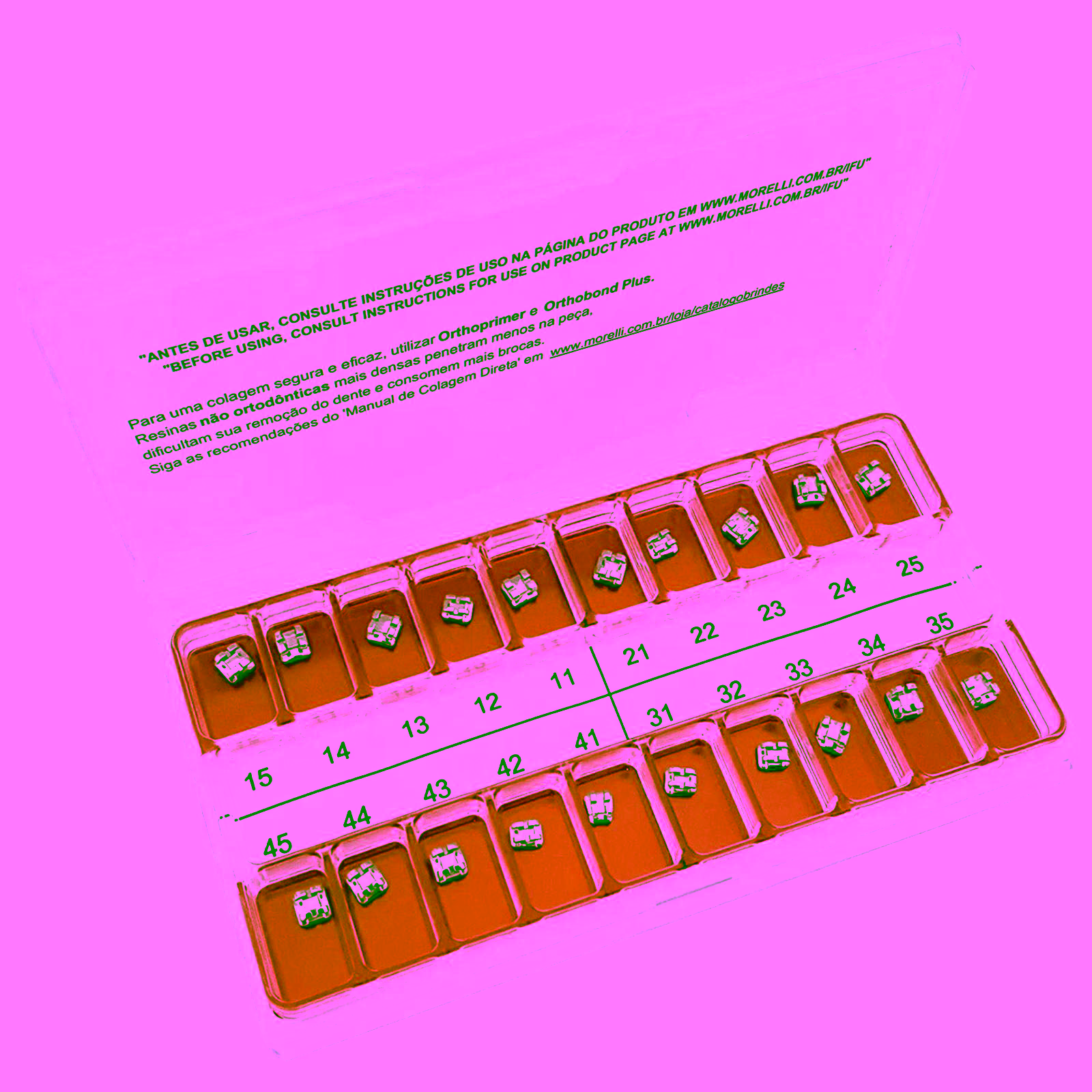 Kit de Brackets 01 caso Prescripción Edgewise Standard .022"