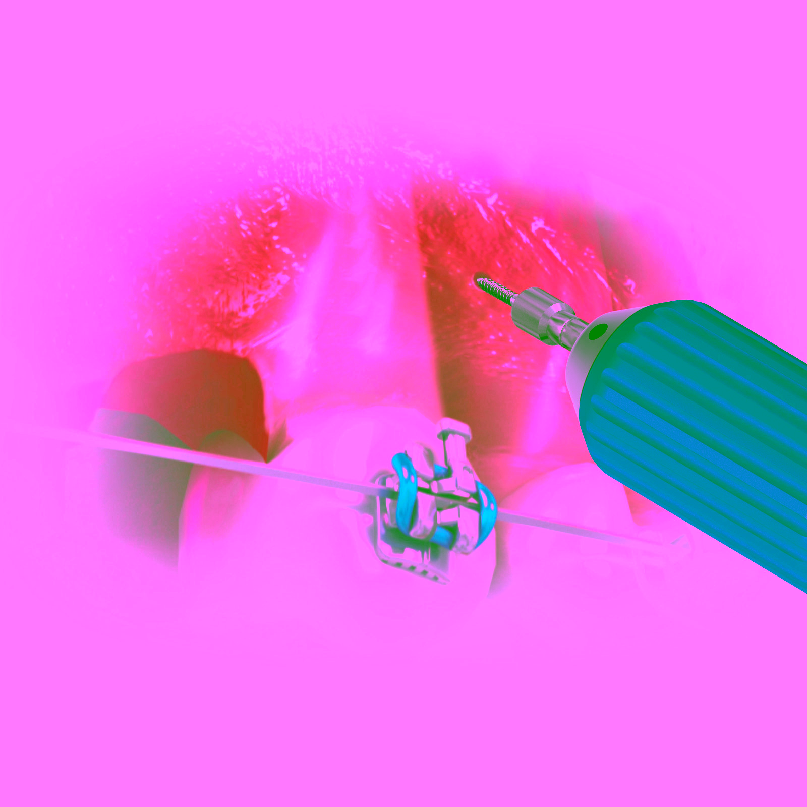 Llave de mano